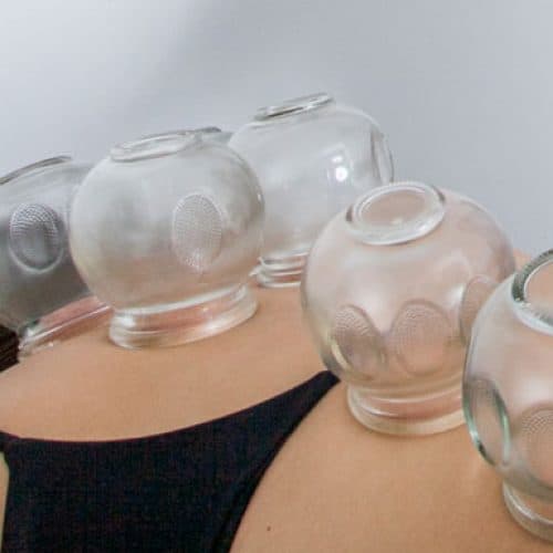 curso-Ventosaterapia